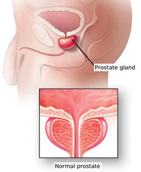 Schématická struktura mužské prostaty